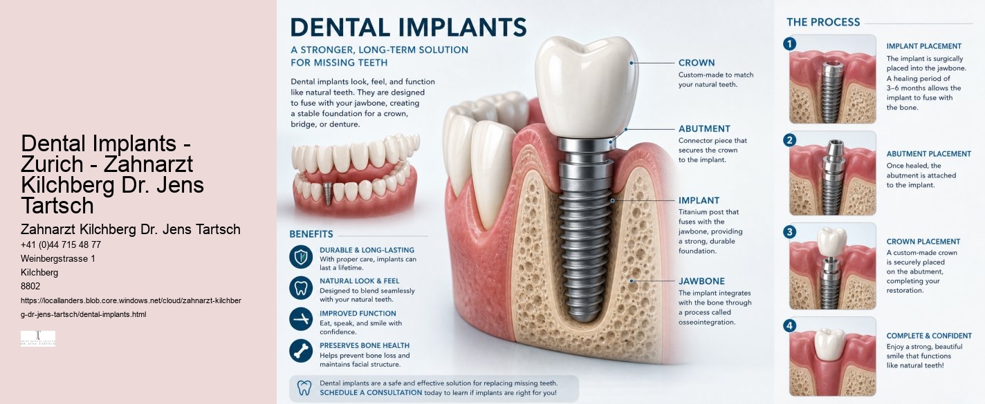 Dental Implants - Zurich - Zahnarzt Kilchberg Dr. Jens Tartsch Zahnarzt Kilchberg Dr. Jens Tartsch Dental Implants - Zurich - Zahnarzt Kilchberg Dr. Jens Tartsch